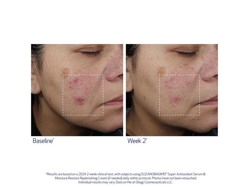 SUZANOBAGIMD Super Antioxidant Serum