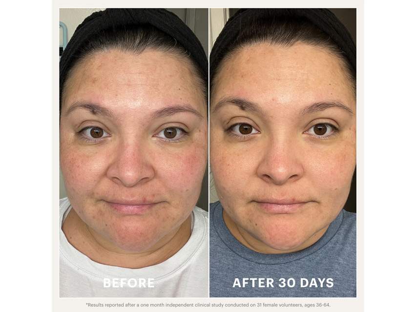 Glo Skin Beauty Renew Serum