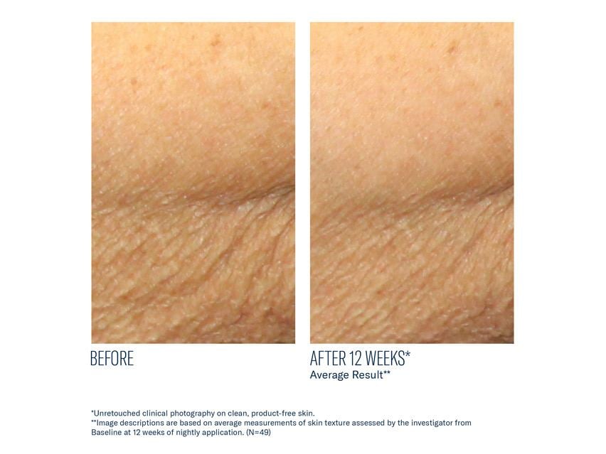 skinbetter science AlphaRet Body Overnight Cream