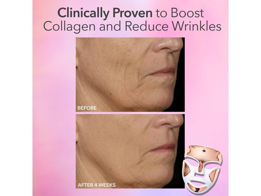 Dr. Dennis Gross Skincare DRx SpectraLite™ FaceWare Pro