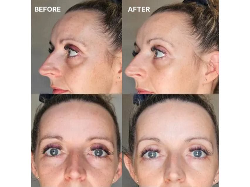 Wrinkles Schminkles Eye Smoothing &amp; Depuffing Sheet Mask