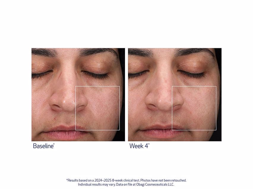 Obagi Retinol + PHA Refining Night Cream