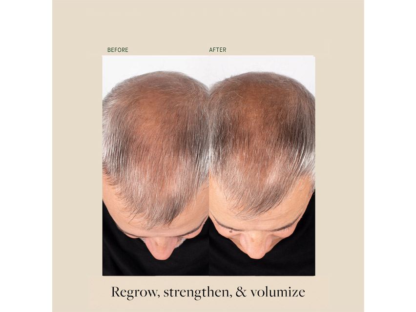 Kat Burki Bio-Ferment Scalp &amp; Hair Treatment