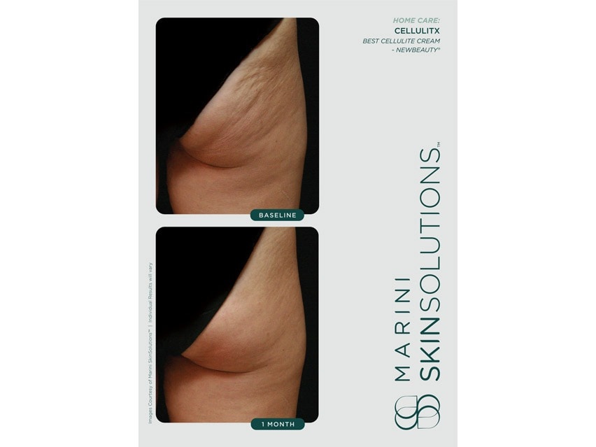 Marini SkinSolutions CelluliTx Cellulite Cream