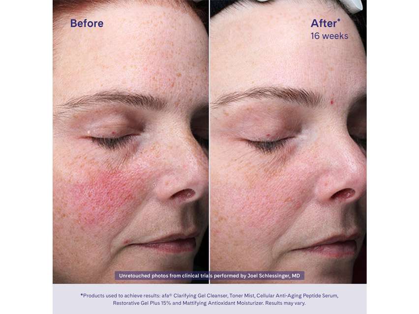 afa Mattifying Antioxidant Moisturizer
