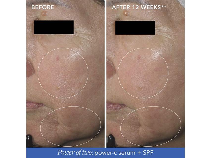 IMAGE Skincare MD Restoring Power-C Serum