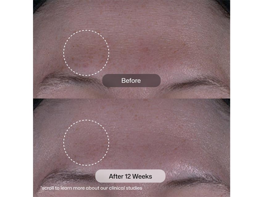 Revision Skincare Tone+ Correcting Pads