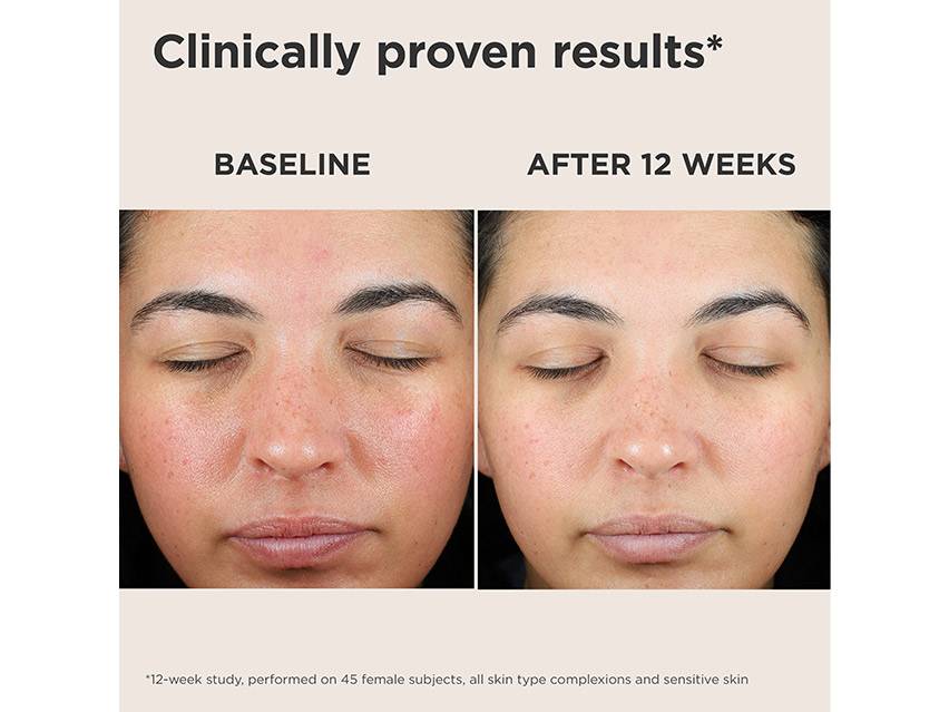 EltaMD UV Skin Recovery Broad Spectrum SPF 50 - Green Tint for Redness