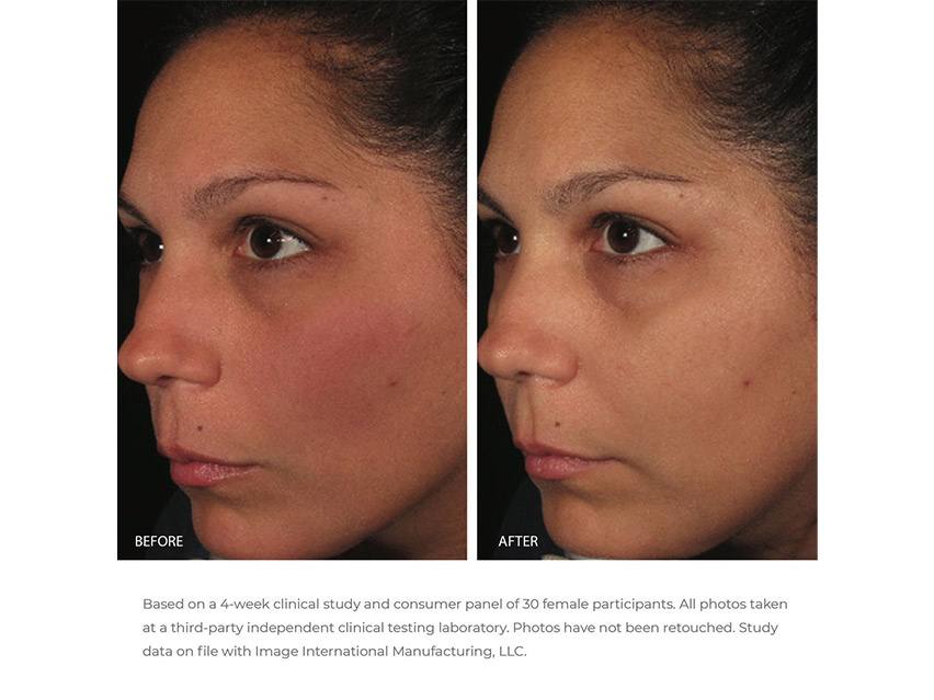 IMAGE Skincare Ormedic Balancing Antioxidant Serum
