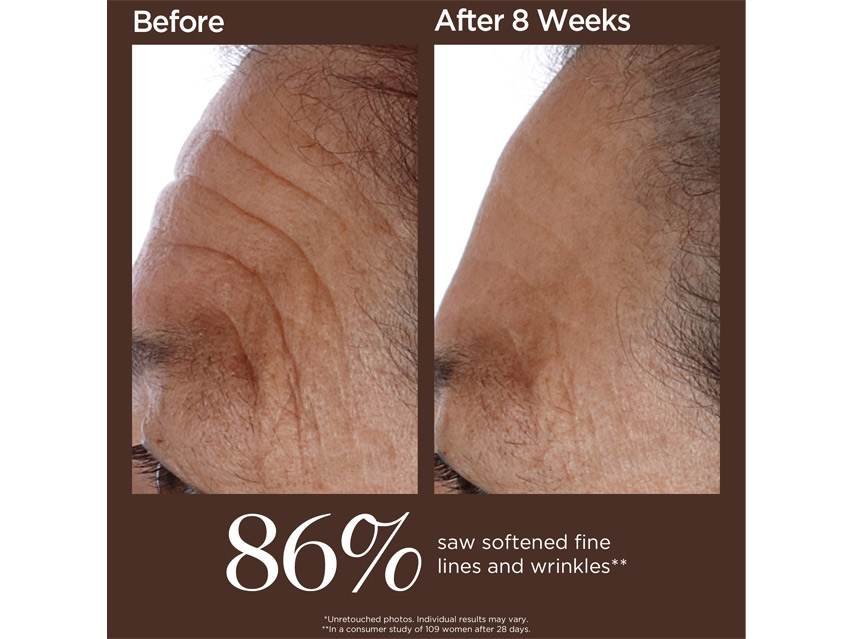 Perricone MD High Potency Hyaluronic Intensive Hydrating Serum