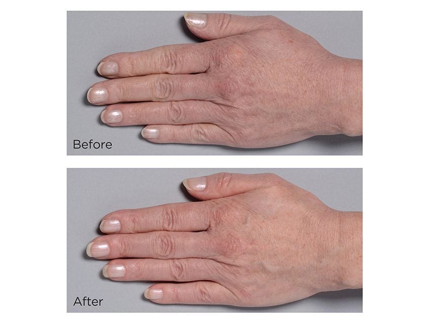 Perricone MD Cold Plasma Plus+ Lip Therapy