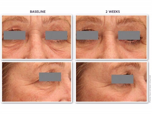 defenage 3d eye radiance cream