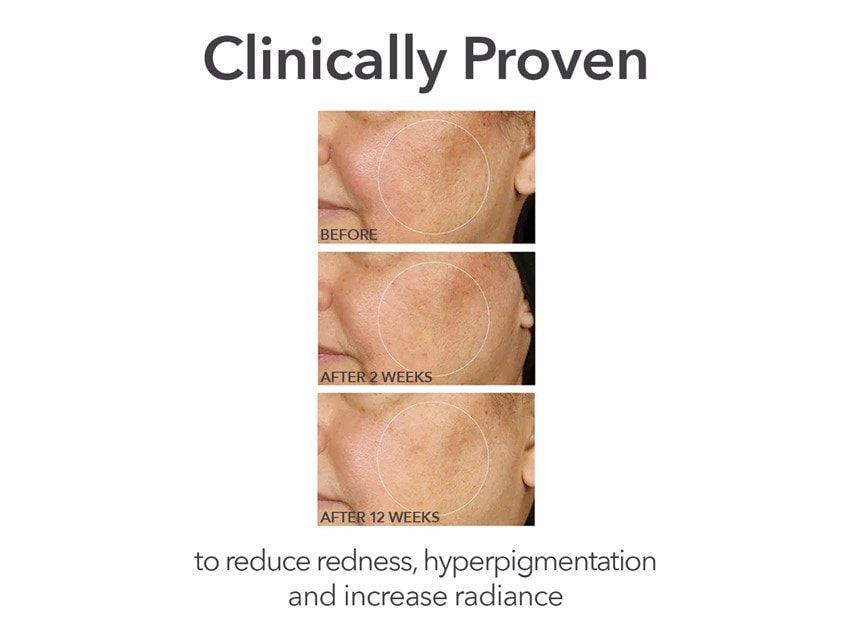 Dr. Dennis Gross Skincare Derminfusion Discovery Kit - Limited Edition