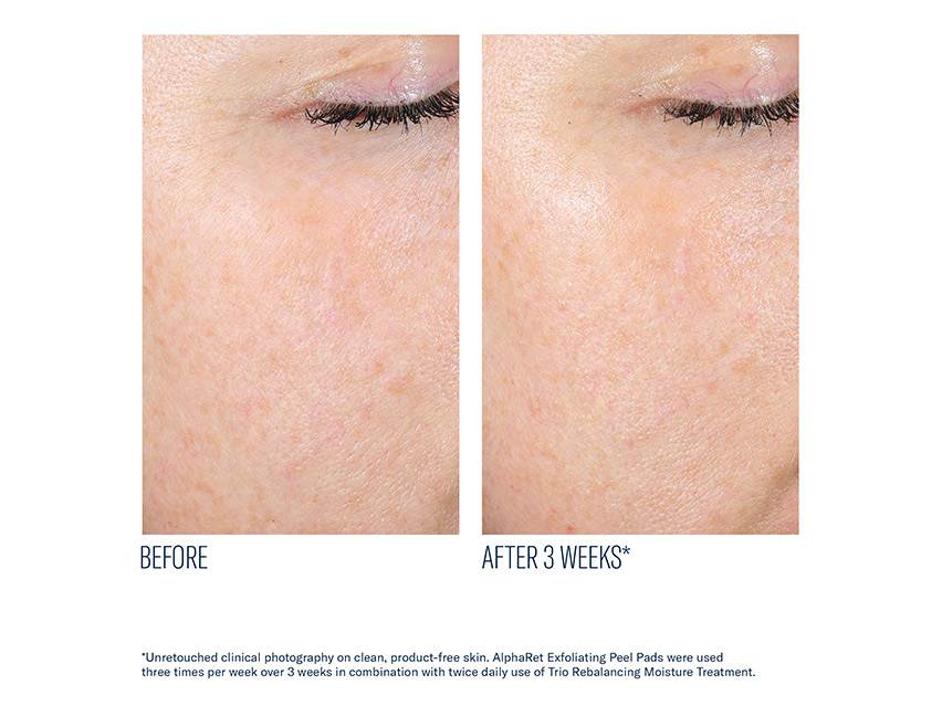 skinbetter science AlphaRet Exfoliating Peel Pads