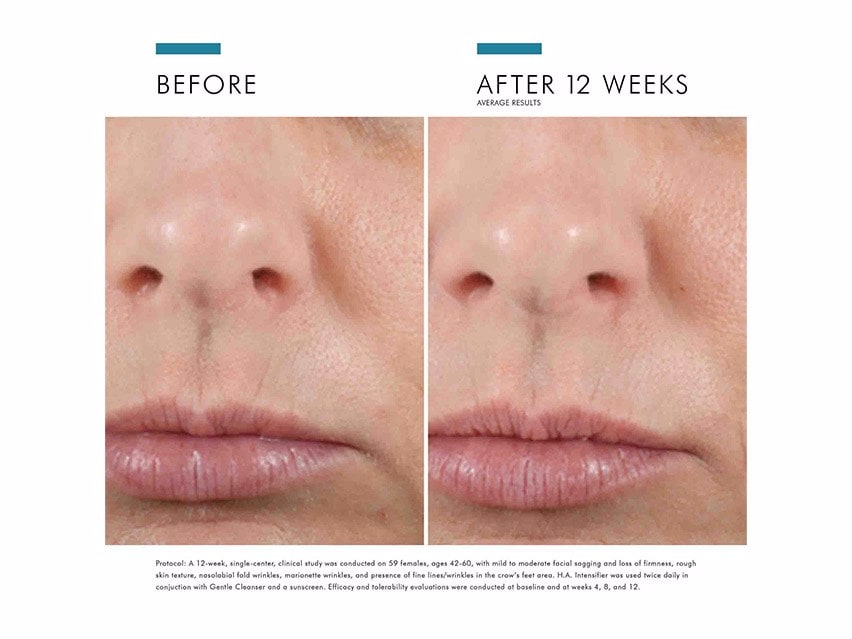 SkinCeuticals Hyaluronic Acid Intensifier Hydrating Serum before and after