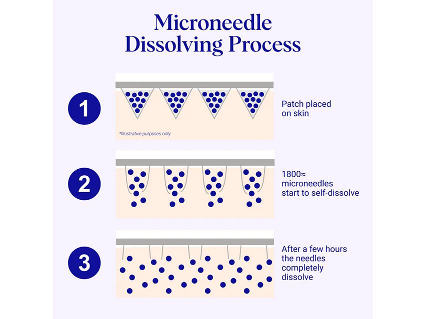 Wrinkles Schminkles Self-Dissolving Microneedle Patches