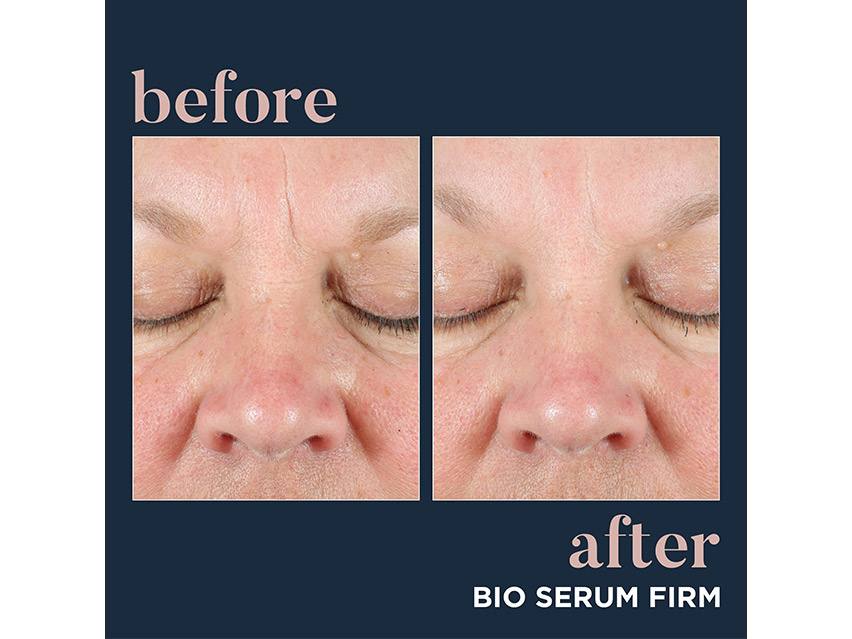 Neocutis Bio Serum Firm Rejuvenating Growth Factor &amp; Peptide Treatment