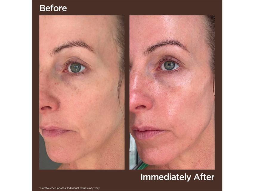 Perricone MD High Potency Classics Face Finishing &amp; Firming Tinted Moisturizer Broad Spectrum SPF 30