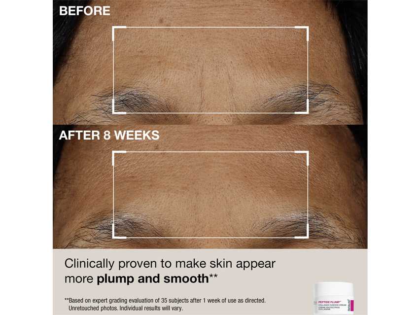 StriVectin Discovery Kit - Limited Edition