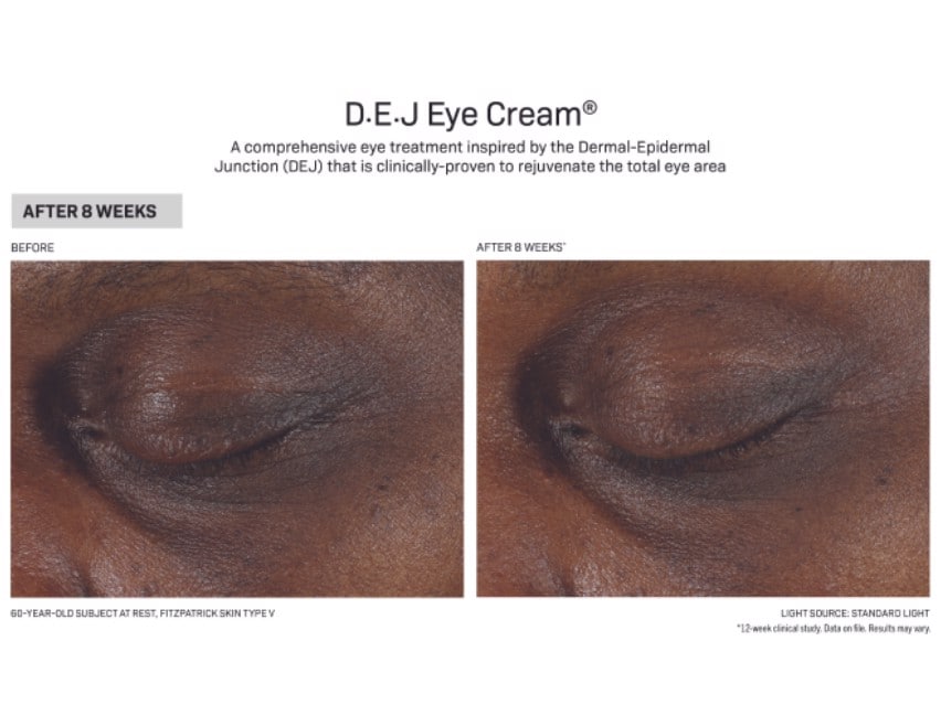 Revision Skincare D·E·J Eye Cream Before and After Results on dark skin