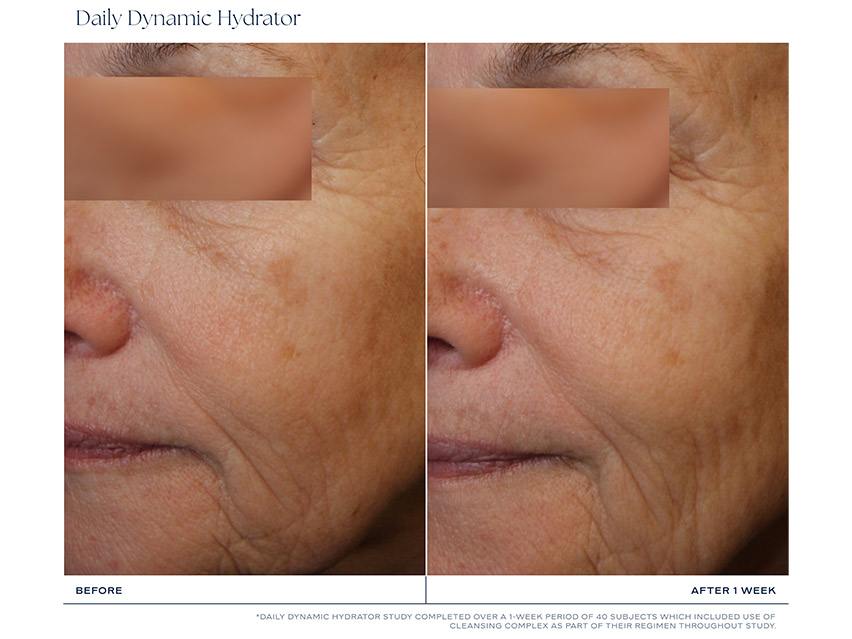 iS CLINICAL Daily Dynamic Hydrator