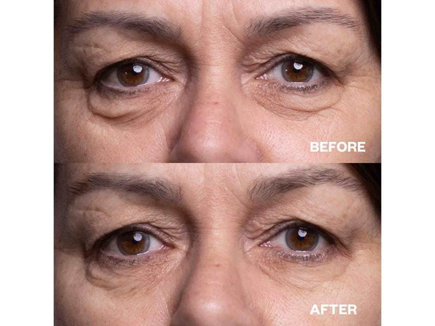 Wrinkles Schminkles Eye Wrinkle Smoothing Patches