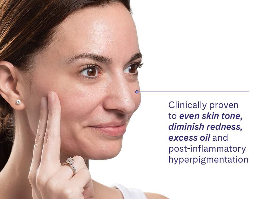 LovelySkin LUXE Exfoliating Gel Max 19%