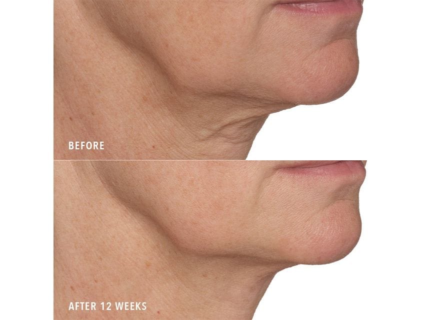HydroPeptide Syner-C+ Vitamin C Serum