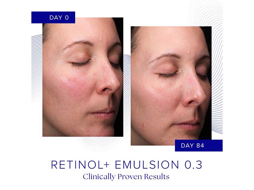 iS CLINICAL Retinol+ Emulsion 0.3 Cream