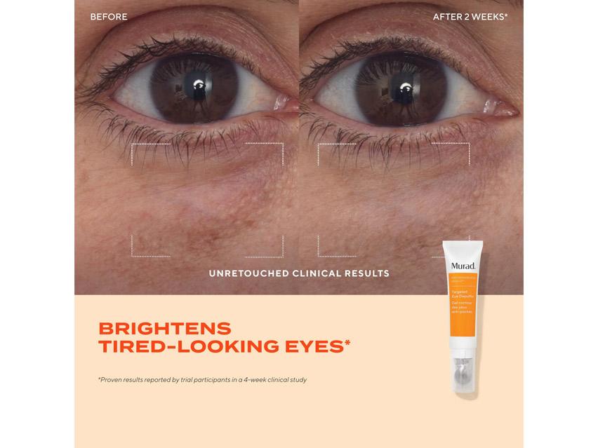Murad Targeted Eye Depuffer