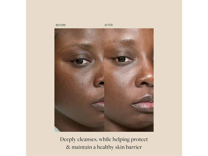 Kat Burki KB5 Calming Gel Cleanser