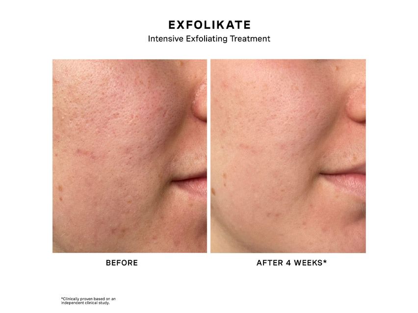 Kate Somerville ExfoliKate Intensive Exfoliating Treatment