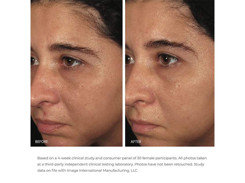 IMAGE Skincare Ormedic Bio-Peptide Creme