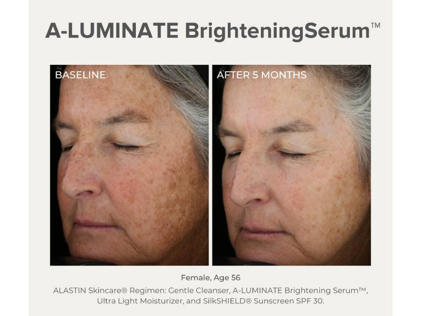 ALASTIN Skincare A-LUMINATE Brightening Serum