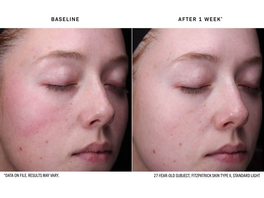 Revision Skincare Radiance+ Resurfacing Serum