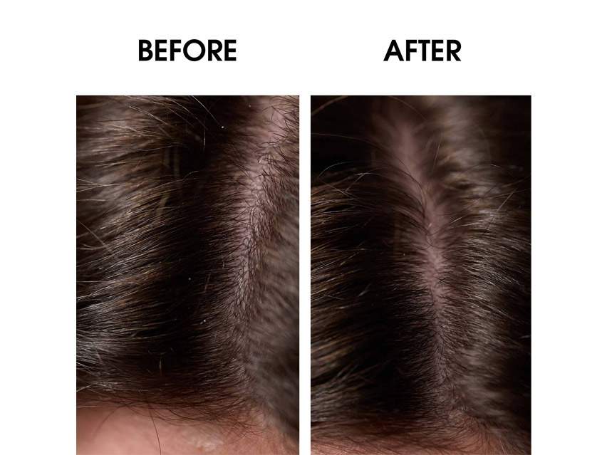 Leonor Greyl Bain Traitant A La Propolis Dandruff Treatment Shampoo