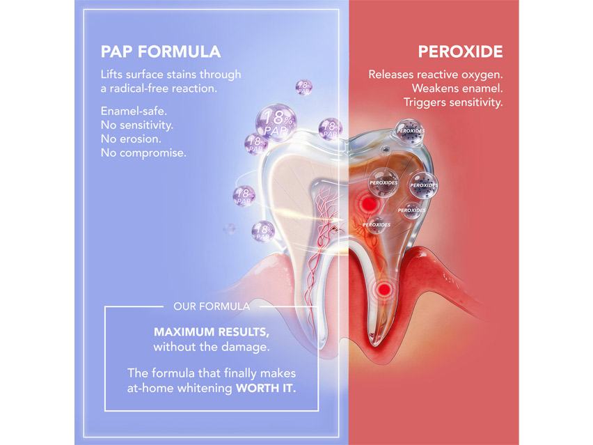 FOREO Issa Teeth Whitening Set &amp; Advanced Teeth Whitening Gel Duo