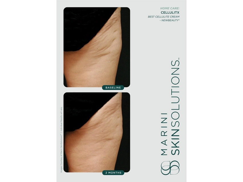 Marini SkinSolutions CelluliTx Cellulite Cream