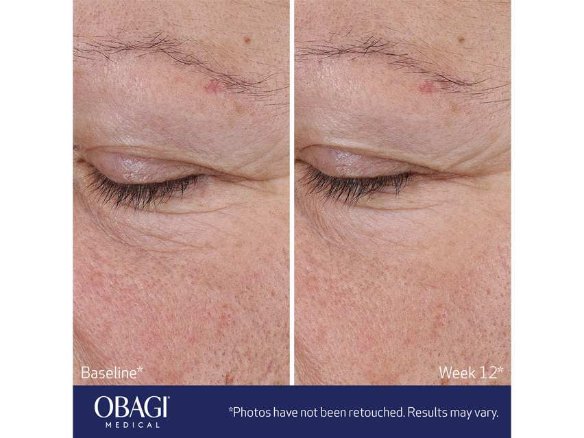 Obagi ELASTIderm Advanced Filler Concentrate