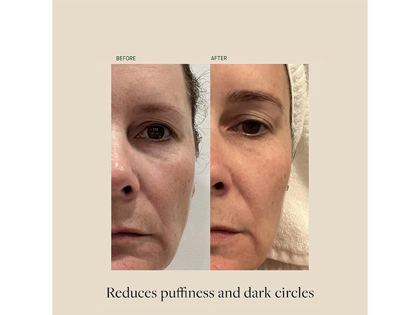 Kat Burki Rose Hip Intense Recovery Eye Serum