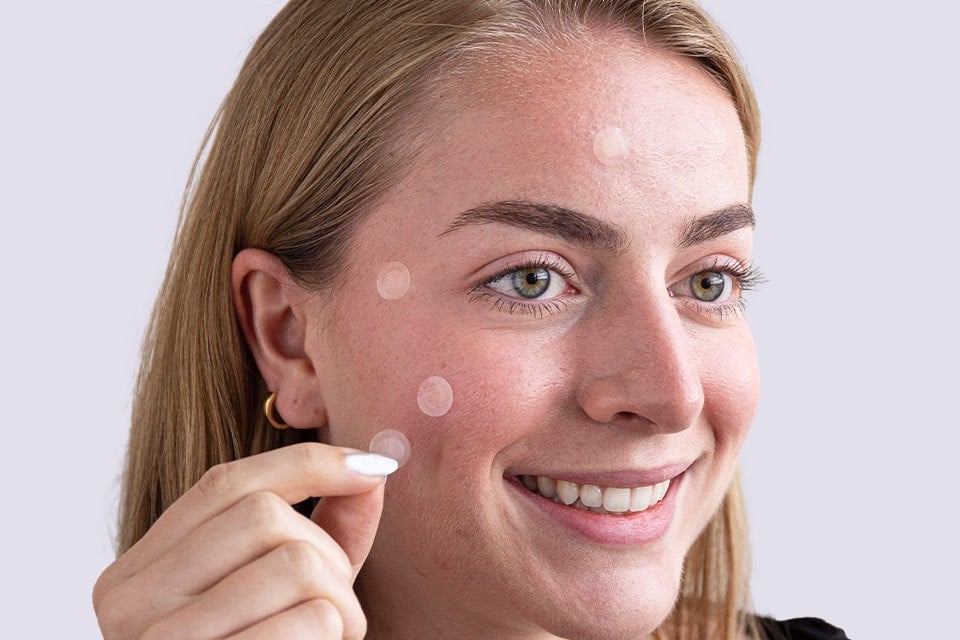 Woman smiling and applying pimple patches