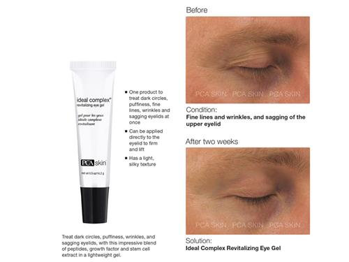 upper eyelid revitalizing eye cream