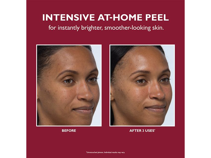 Peter Thomas Roth Even Smoother Instant Reveal Facial Peel