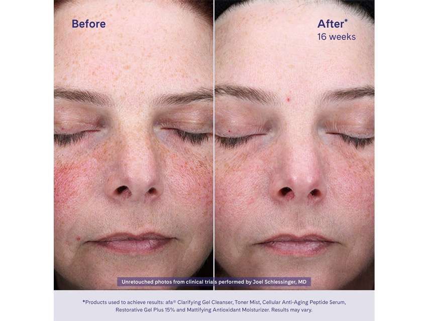 afa Restorative Gel Plus