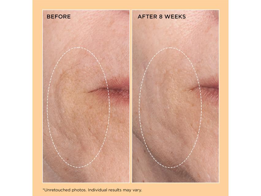 Perricone MD Neuropeptide Rejuvenating Moisturizer Broad Spectrum SPF 25