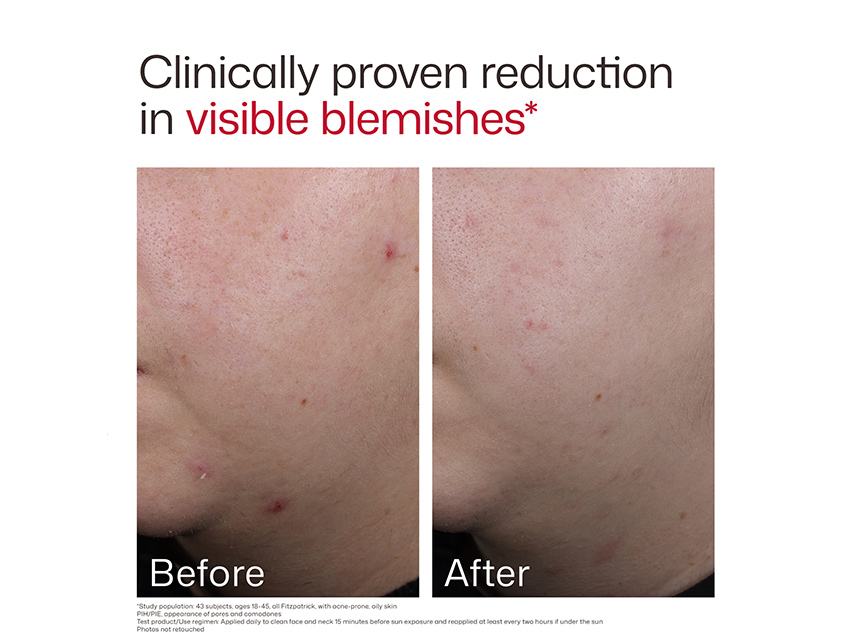 EltaMD UV Clear Blemish-Prone &amp; Oil Balancing SPF 50