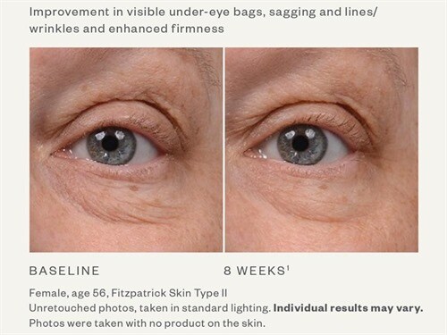 skinmedica instant bright eye