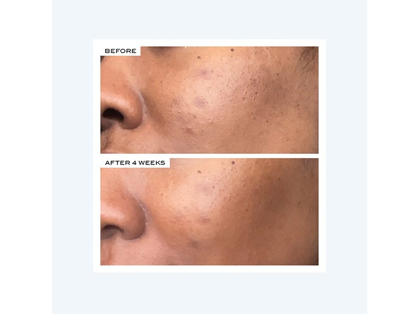 111SKIN Precision Peel