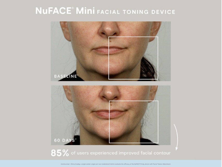 NuFACE mini Facial Toning Device - White