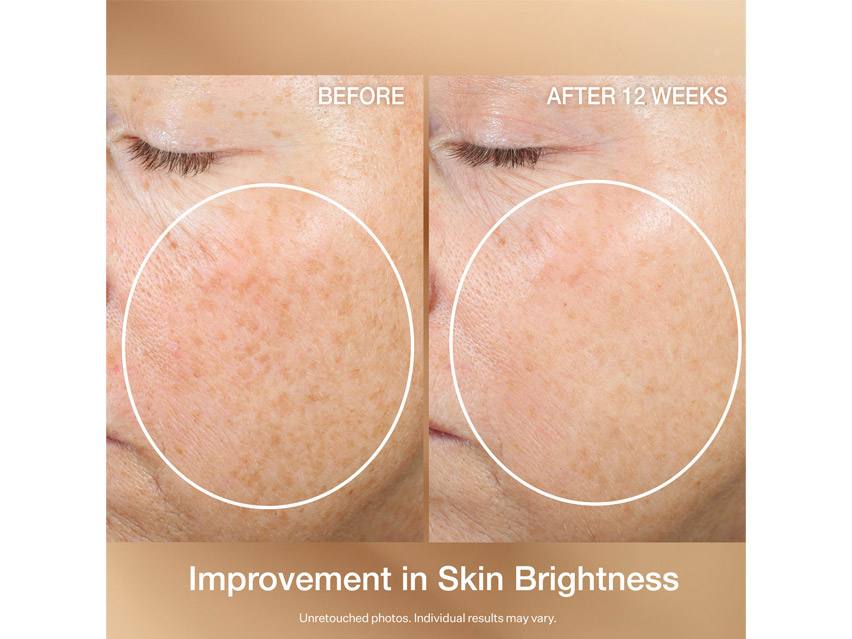 StriVectin Multi-Action Super-C Retinol Brighten &amp; Correct Vitamin C Serum